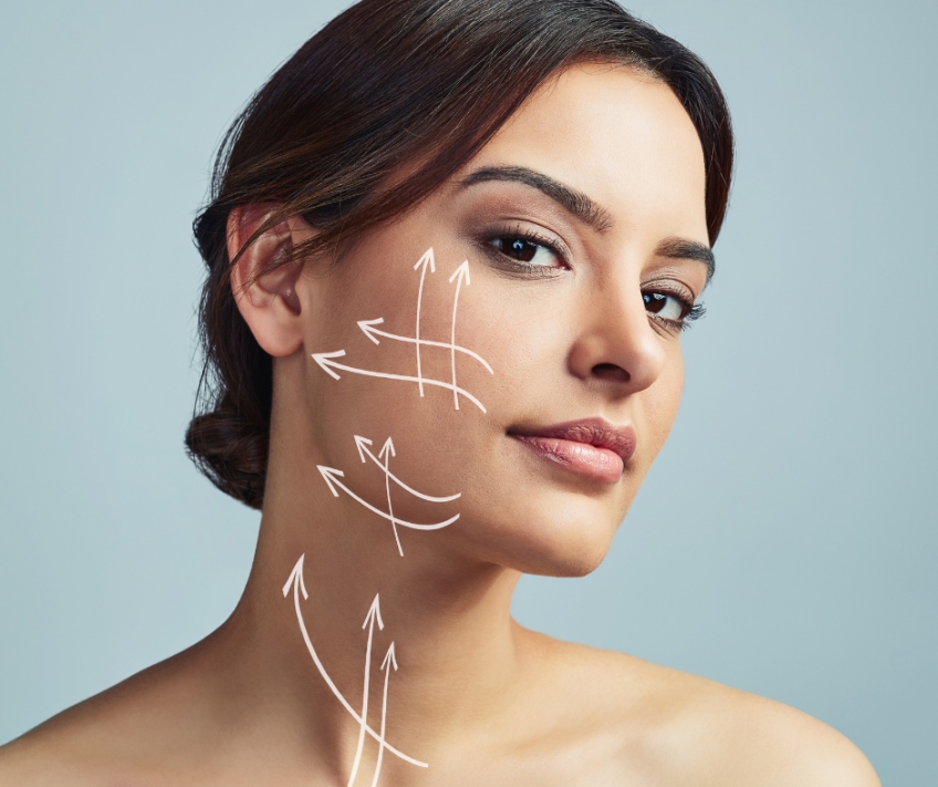Facial contouring treatment illustration on a woman.