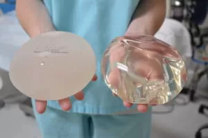 The Question How Long Do Breast Implants Last Is Determined By What Type Of Breast Implant is Used